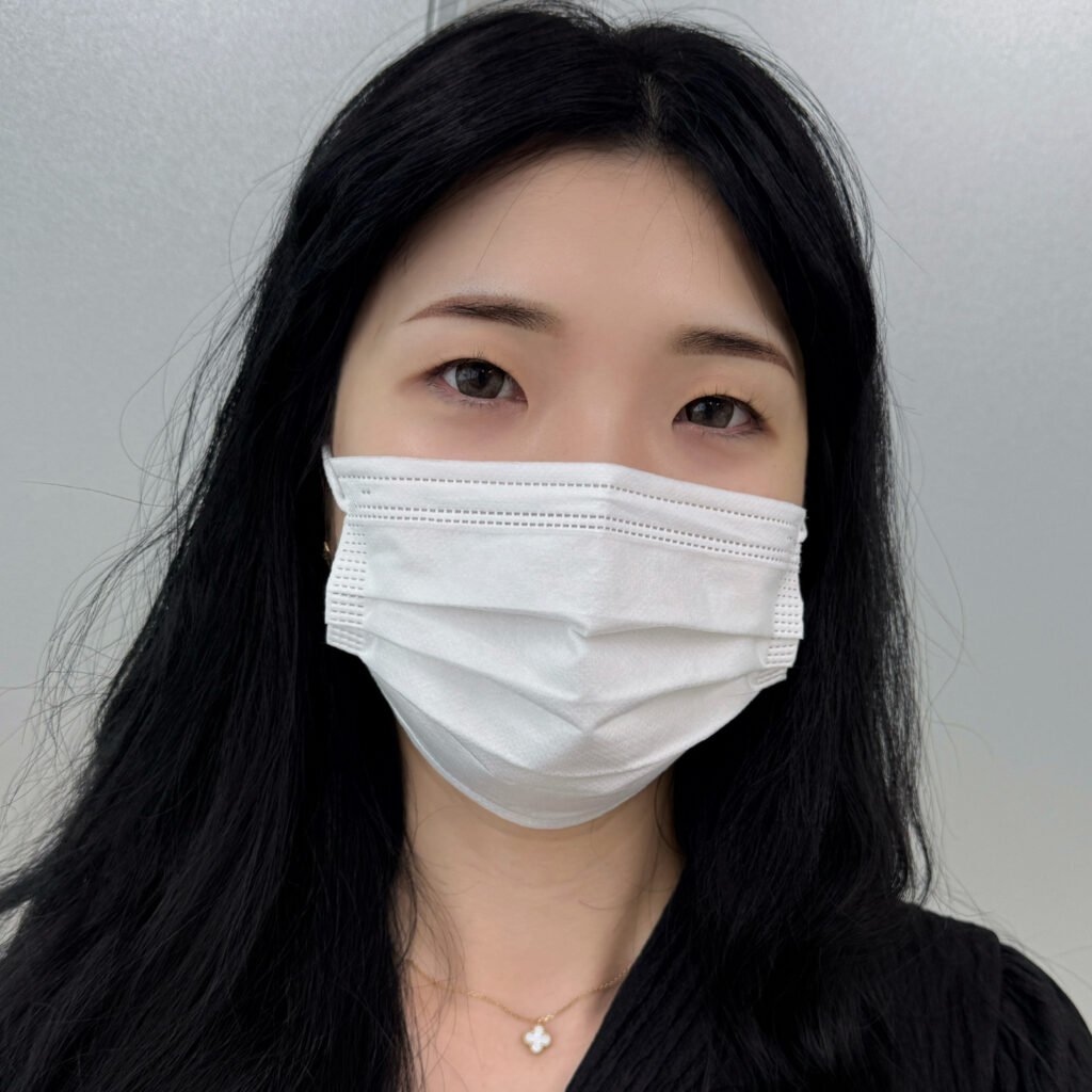 부천눈썹문신 전문점 티메스의 눈썹 직후