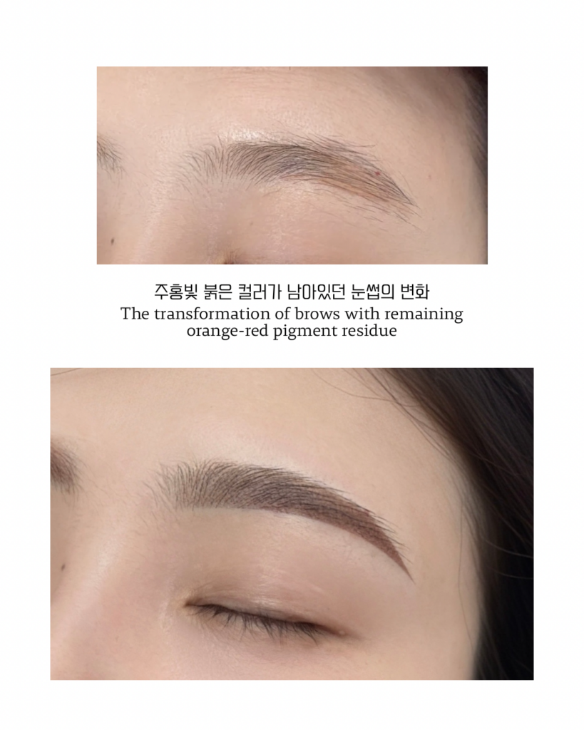 계양구 눈썹문신 티메스의 주홍빛 잔흔 케이스