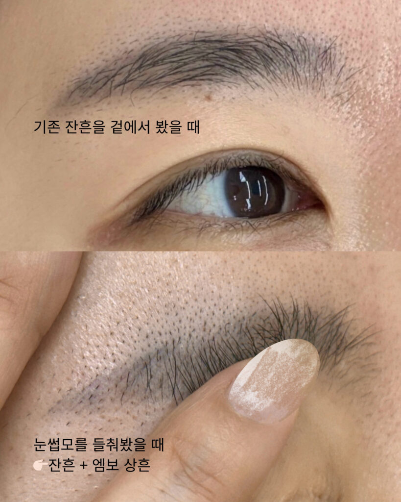 삼산동눈썹문신 검은 잔흔 케이스
