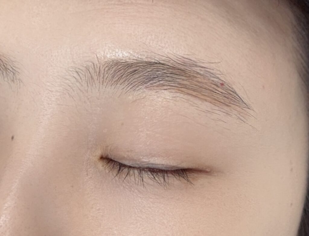 부천 눈썹문신 붉은 잔흔 시술 전 모습